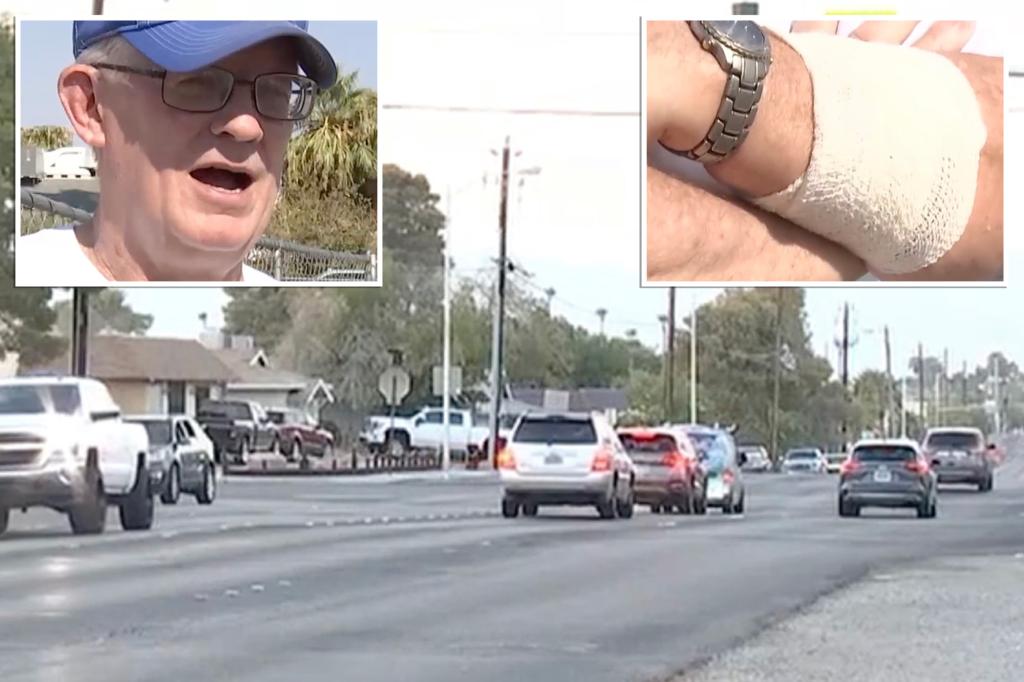 Las Vegas Republican candidate slashed by knife-wielding thug while putting up campaign